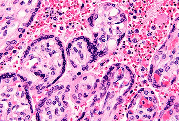 A keleti nyugdíjak 2020-ra érik el a nyugati szintet